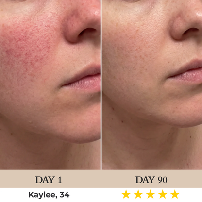 Nuvéa™ 7-in-1 LED Face Mask