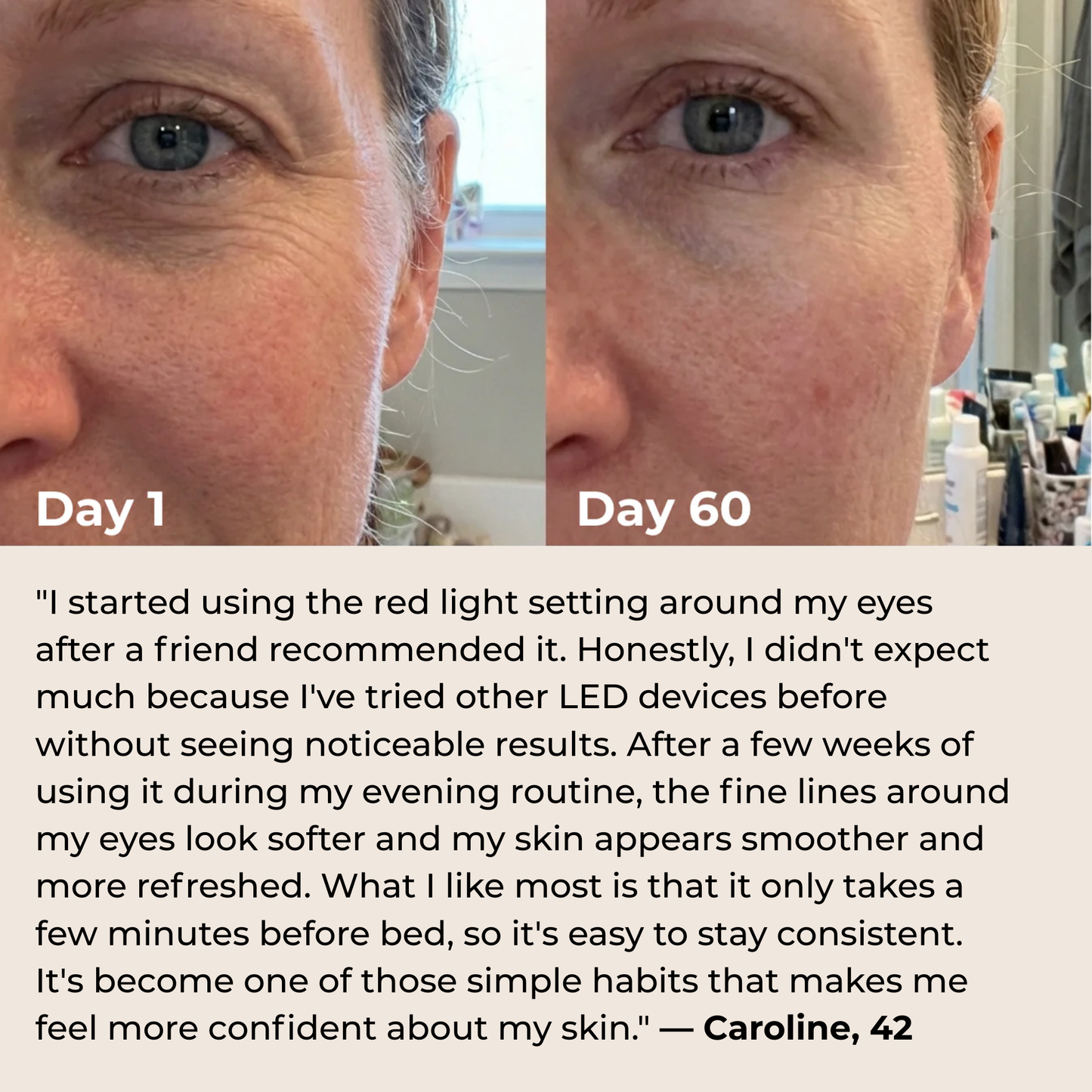 Nuvéa™ 7-in-1 LED Facial Sculptor