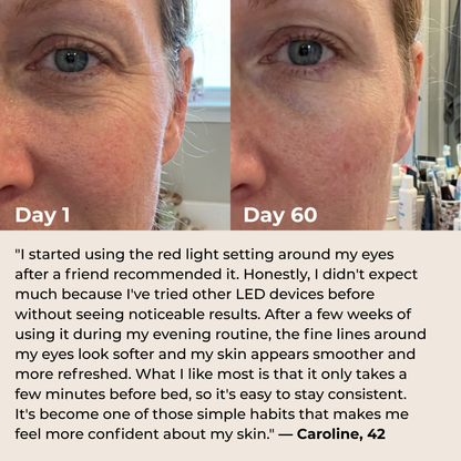 Nuvéa™ 7-in-1 LED Facial Sculptor
