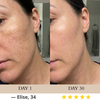 Nuvéa™ 7-in-1 LED Facial Sculptor