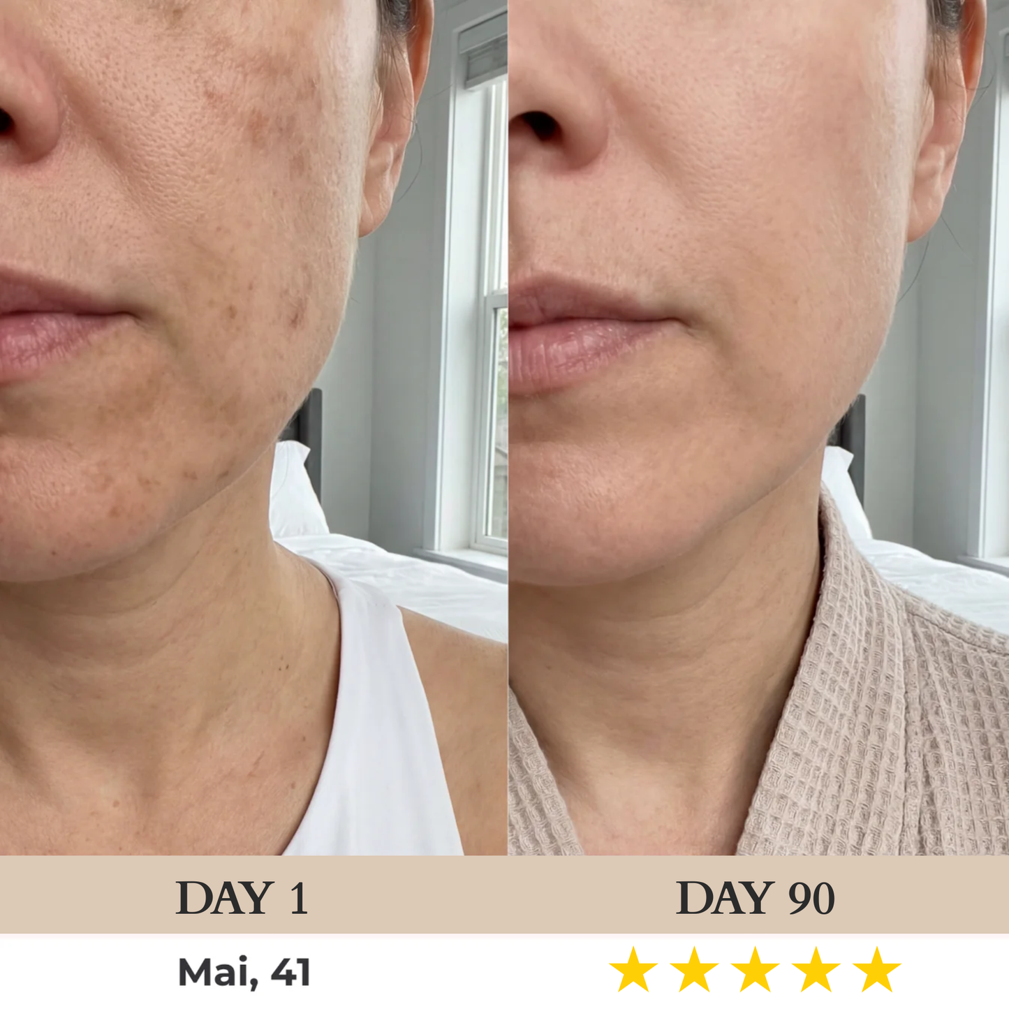 Nuvéa™ 7-in-1 LED Face Mask