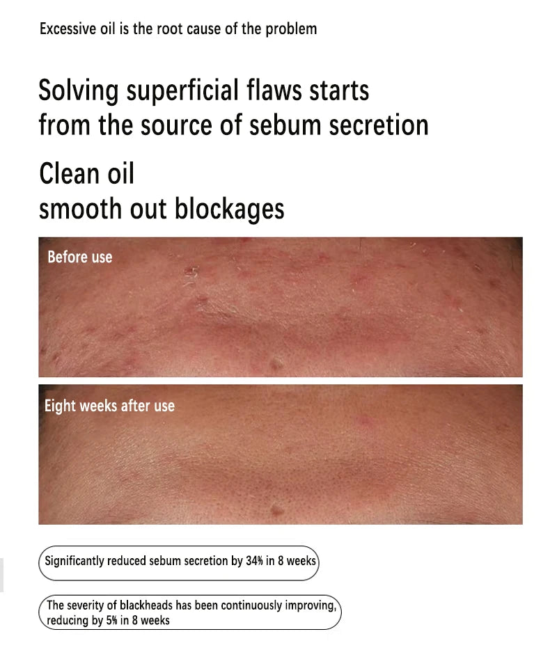 Nuvéa™ Skin Solutions