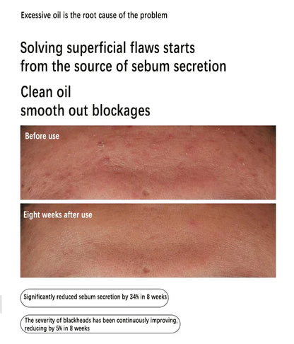 Nuvéa™ Skin Solutions