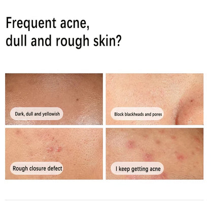 Nuvéa™ Skin Solutions